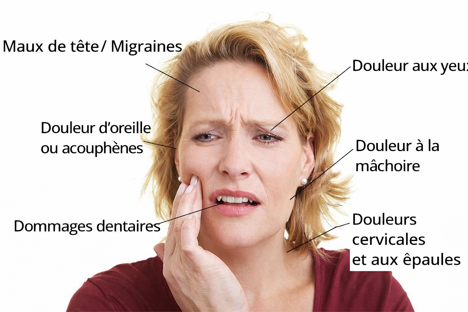Symptômes des troubles de l'ATM - maux de tête, douleur mâchoire, douleur oreille, douleurs cervicales