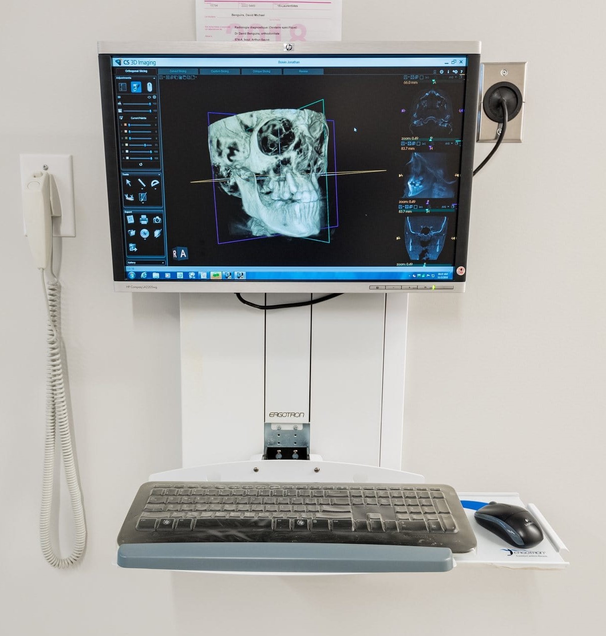 Scanner CBCT CS 3D Imaging - visualisation cranio-faciale en clinique