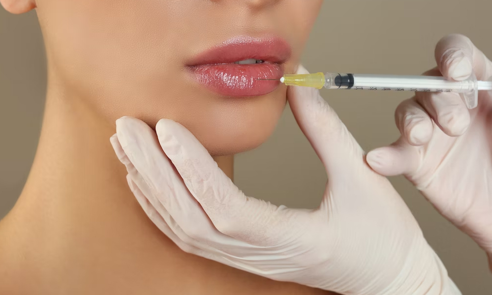 Dermal fillers - lip injection hyaluronic acid